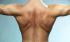 Back Pain Cures - 15 Awesome Natural Home Remedies photo